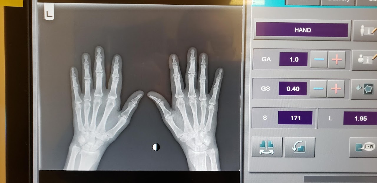 Digital X-Rays